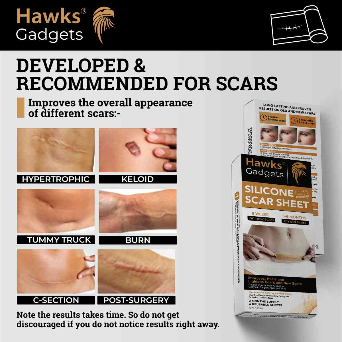 SILICONE SCAR SHEET