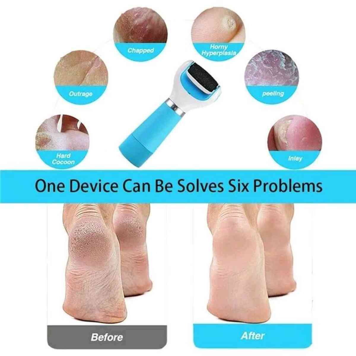 Electronic Foot File Roller Callus Remover USB Cable Include