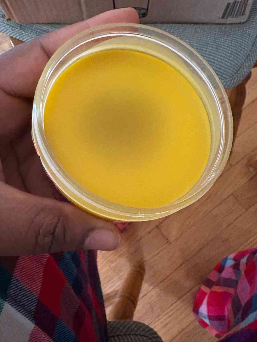 Homemade stretch mark butter